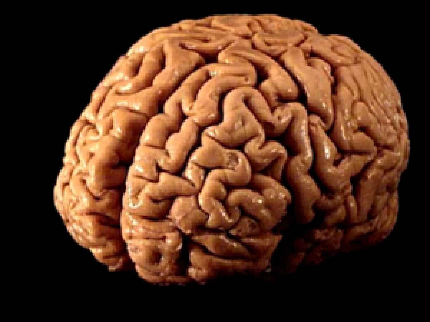 Brain 52